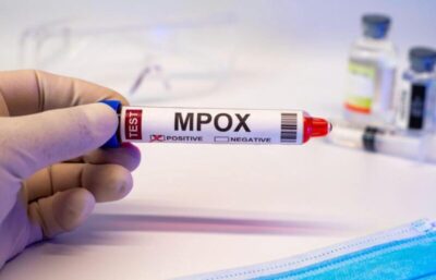 Brasil registra 88 casos de mpox em 2026