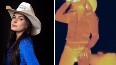 Especialistas explicam que soltar gases é processo natural do corpo humano