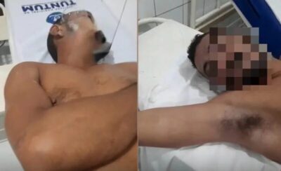 Tragédia em Tuntum: dois trabalhadores morrem com suspeita de envenenamento após ingerir líquido por engano