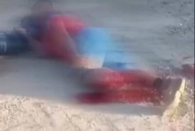 Motociclista tem perna amputada após grave acidente no interior do Maranhão