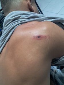 RESPOSTA RÁPIDA: SUSPEITO DE LATROCÍNIO QUE VITIMOU IDOSO É PRESO EM SÃO LUÍS