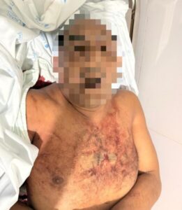 HOMICÍDIO NO DIA 1º DE JANEIRO CHOCA CODÓ: HOMEM É MORTO A FACADAS DENTRO DE CASA NO BAIRRO CODÓ NOVO