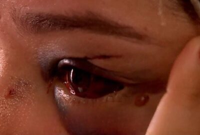 Mulher relata luta para sobreviver após tentativa de feminicídio na Cidade Operária, em São Luís