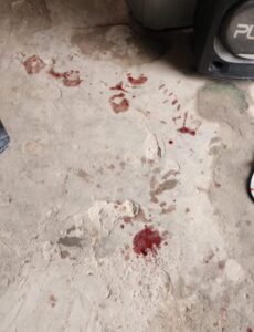 VIOLÊNCIA DOMÉSTICA EM CODÓ: MULHER É AGREDIDA, MAS SE RECUSA A DENUNCIAR COMPANHEIRO