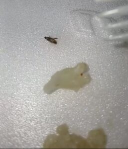 Hospital do Servidor diz em nota que está apurando caso de inseto encontrado em comida de paciente