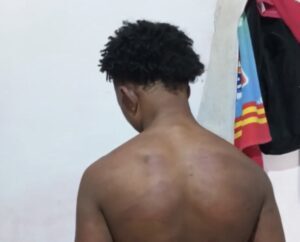 Polícia Civil investiga caso de jovem de 17 anos agredido por policial militar