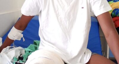 Adolescente de 15 anos é baleado após ser confundido com outra pessoa em Trizidela do Vale