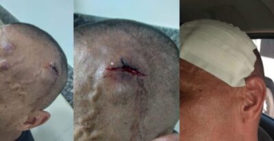 Árbitro é agredido por torcedores após jogo da Copa Interbairros em São Luís