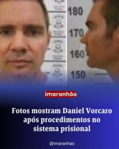 Fotos mostram Daniel Vorcaro após procedimentos no sistema prisional