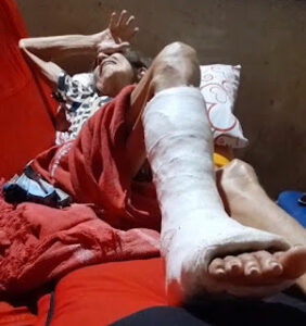 COMOÇÃO! População de Bom Lugar denuncia mais um descaso de Marcos Miranda na saúde