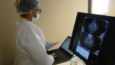 Exames gratuitos de mamografia e preventivo chegam à região da Cohama, em São Luís; saiba como agendar