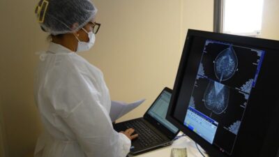 Sesc Saúde Mulher leva mamografias e preventivos gratuitos na região da Cohama