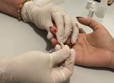 Prefeitura de Grajaú realiza testagem e ações de prevenção ao HIV durante o Dezembro Vermelho