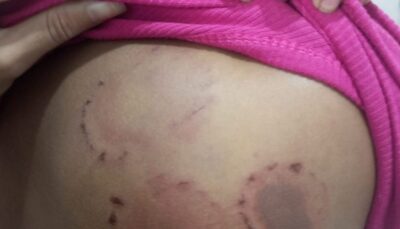 Homem é preso em flagrante após agredir companheira com socos e mordidas em Pinheiro