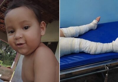 Criança fica ferida em incêndio criminoso e bebê de dois anos morre afogado em cidades da Baixada Maranhense