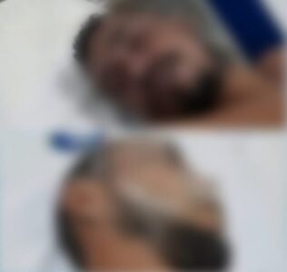 Polícia Civil investiga suspeita de envenenamento após morte de dois trabalhadores em Tuntum