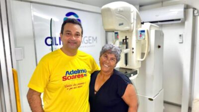 Adelmo Soares promove mutirão de saúde da mulher com tratamento inédito de varizes no Maranhão