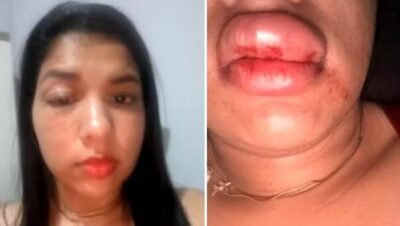 Jovem diz que está se escondendo após agressão de vereador em Maurilândia