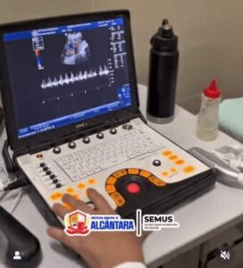 Alcântara-MA: Hospital Dr. Neto Guterres realiza mutirão de exames de ultrassonografia para homens e mulheres