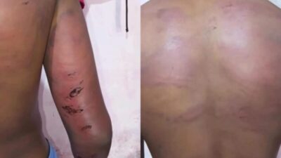 PM é afastado após denúncia de tortura contra adolescente em Trizidela do Vale