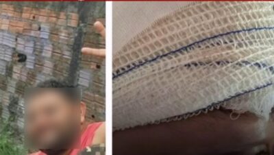 Mulher é agredida com pauladas pelo companheiro no Anjo da Guarda