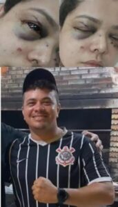 Ex-marido atraiu enfermeira alegando que a filha estava com febre e atacou Sarah Julia no rosto com uma faca de serra