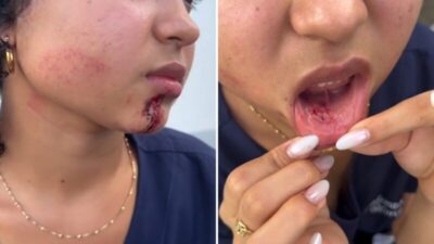 Jovem é agredida no rosto por homem dentro de ônibus em São Luís; polícia investiga o caso como roubo