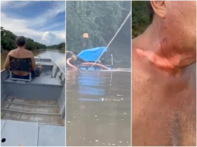 Por pouco não vira tragédia: codoense tem pescoço ferido por cabo de aço ao atravessar rio