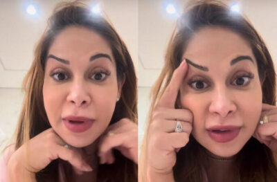 Maíra Cardi exibe rosto deformado após botox dar errado: ‘Olha que palhaçada’