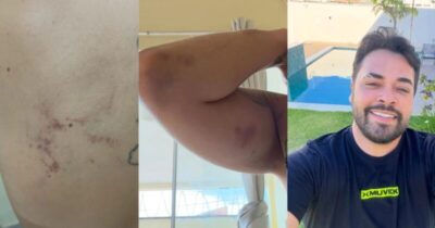 Polícia Civil investiga agressão do cantor Andson Mendonça a esposa na véspera do Natal