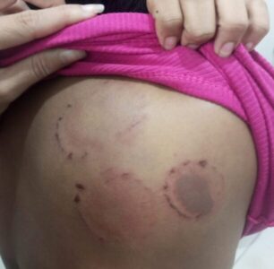 POLÍCIA CIVIL PRENDE HOMEM SUSPEITO DE AGREDIR E ABUSAR DA NAMORADA EM PINHEIRO