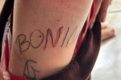 Covardia e brutalidade!!! Mulher é torturada e tatuada à força por companheiro. Imagens fortes