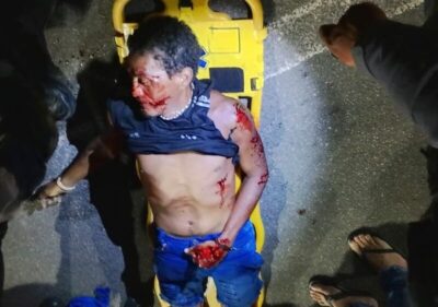 Ciclista morre após colisão com carro na Avenida Vitorino Freire, em São Luís