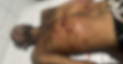 Homem é assassinado com vários disparos de arma de fogo em Vargem Grande