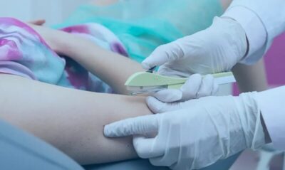 Ministério da Saúde qualifica 440 profissionais no Maranhão para ampliar oferta de implante contraceptivo