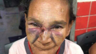 Agressão covarde: idosa de 68 anos é espancada e filho é investigado por omissão