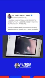 Médico Prefeito do interior implanta procedimento pela primeira vez na Região Munim e reduzirá casos de de câncer