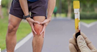 Medicina Regenerativa: a nova fronteira no tratamento das Lesões Crônicas