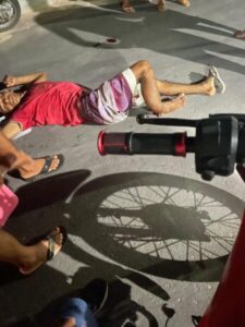 Motociclista que estava empinando sofre fratura exposta na perna em Barreirinhas