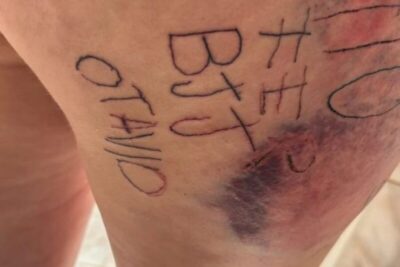 Mulher é torturada e tatuada à força por companheiro