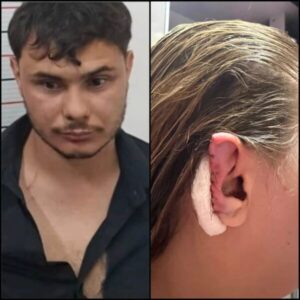 Homem é acusado de morder e mutilar orelha de ex-companheira em SP