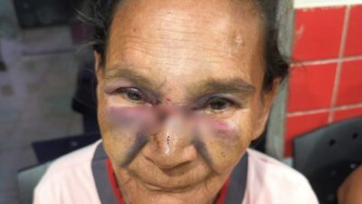 Agressão covarde: idosa de 68 anos é espancada e filho é investigado por omissão